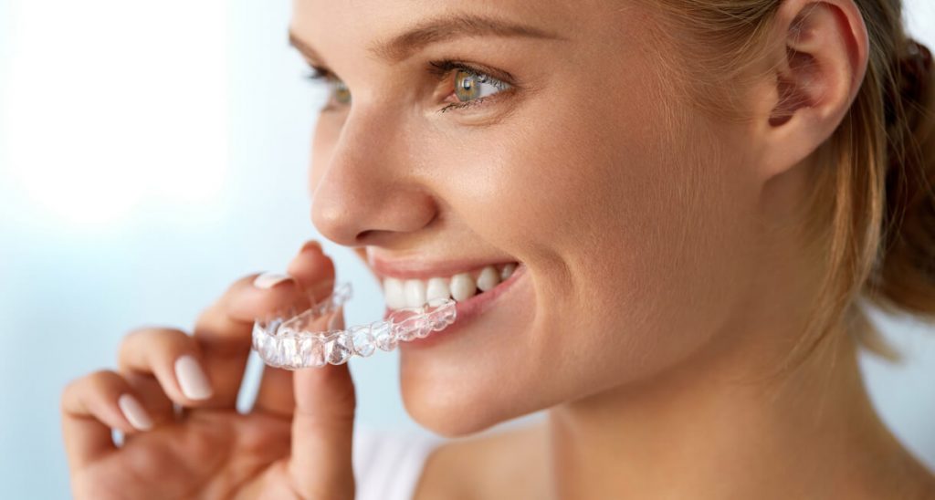 Invisalign